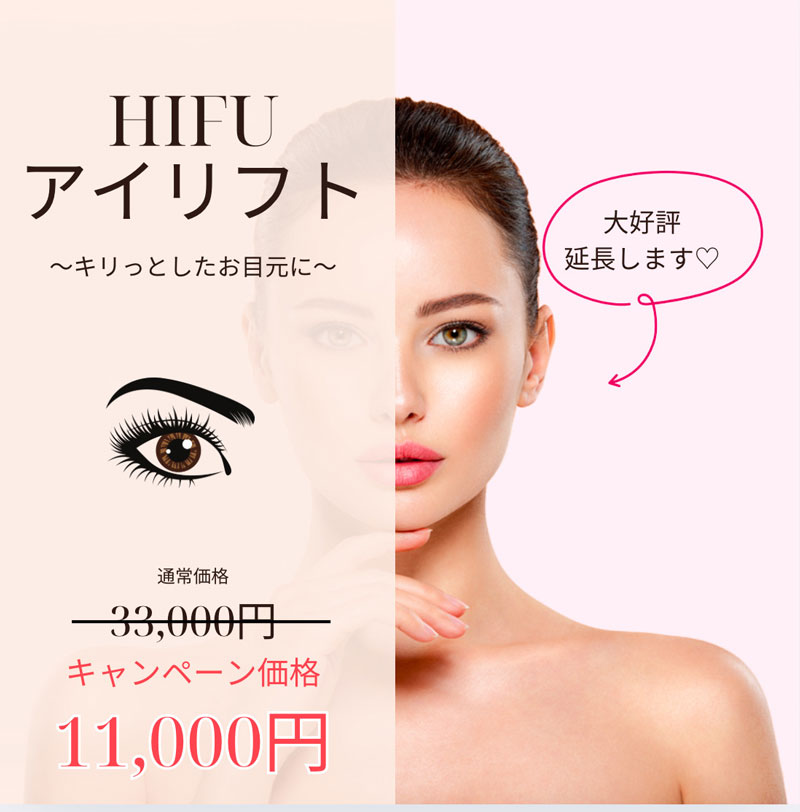3月キャンペーン