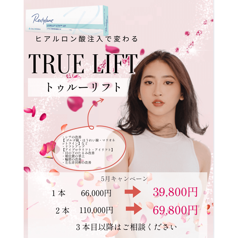 5月キャンペーン