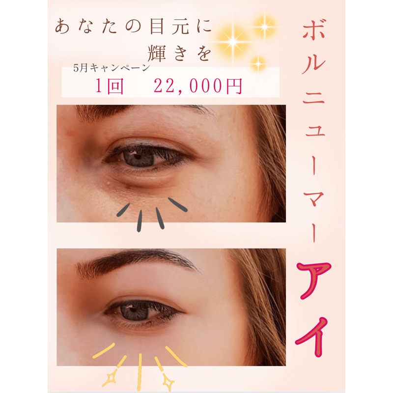 5月キャンペーン
