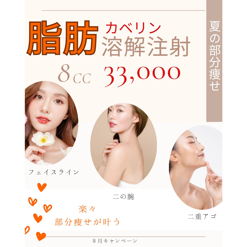 8月キャンペーン